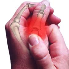Top 5 Ways to Relieve Arthritis Pain